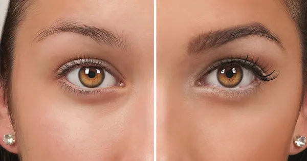 نگاهی از نزدیک به فرایند کاشت ابرو در مجهزترین کلینیک مشهد