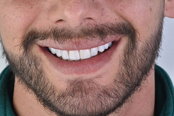 دندانپزشکی دماوند