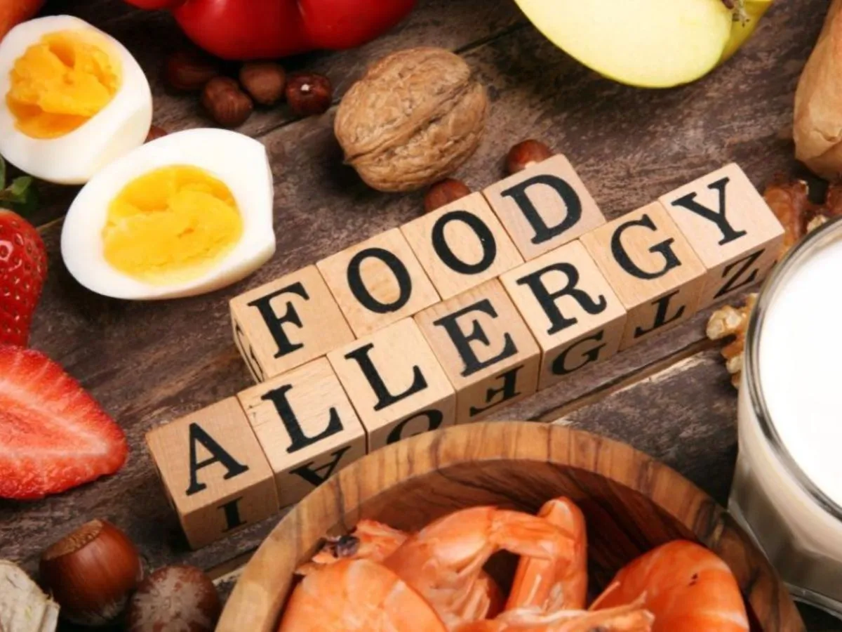آلرژی غذایی؛ شناخت واکنشهای ایمنی بدن و استراتژیهای حیاتی برای زندگی ایمن آلرژی غذایی؛ شناخت واکنشهای ایمنی بدن و استراتژیهای حیاتی برای زندگی ایمن